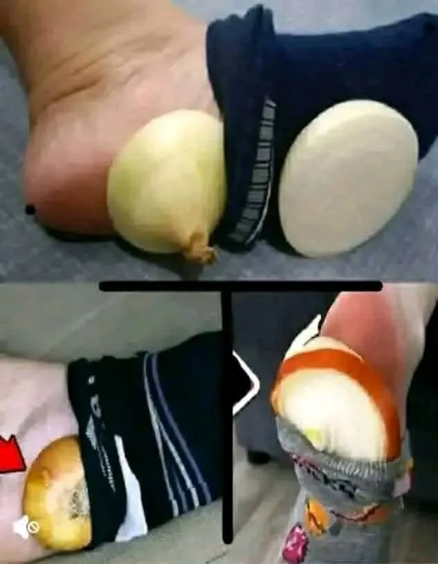 مفاجـ.ــأة ستحـدث لأي رجل متـ,ــزوج ماذا يحـدث بعد وضع البصل أسفل باطن