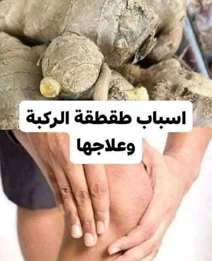 أسباب طقطقة الركبة وعلاجها